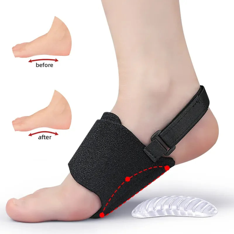 MediFoot Arch Support Brace